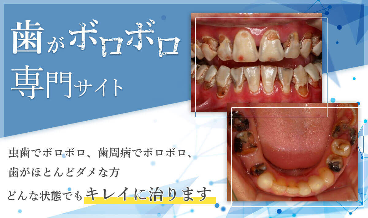 歯がボロボロ専門サイト