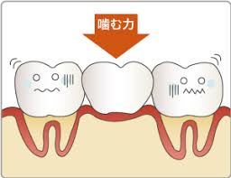 x鎕ɕS