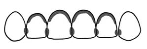上の前歯の、歯と歯の間、歯のつけ根