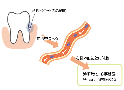 歯周病菌
