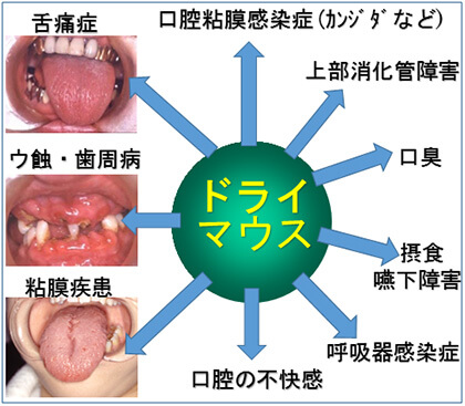 口 の 中 しょっぱい 更年期