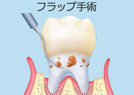 頭 を 叩く と 歯 に 響く