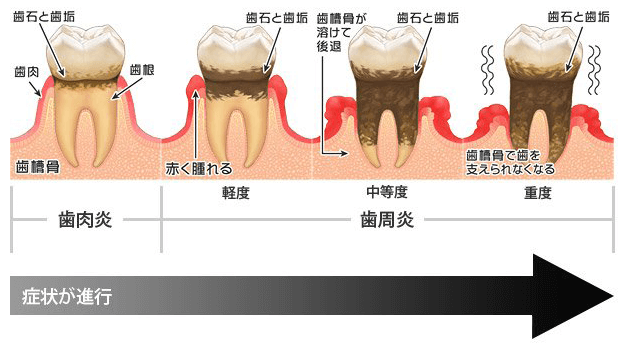 玕aւ̕a̐is