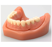 ロケーター義歯の特徴3
