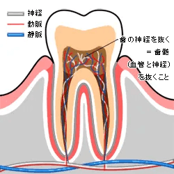 歯の神経の解説