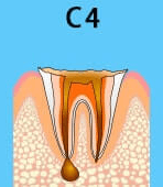 C4